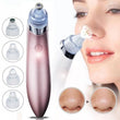 Load image into Gallery viewer, Black Head Cleaning Apparatus Pore Cleaning Technology