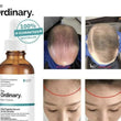 Load image into Gallery viewer, Ordinary hair care serum