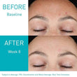 Load image into Gallery viewer, CeraVe skin renewing & resurfacing retinol serums