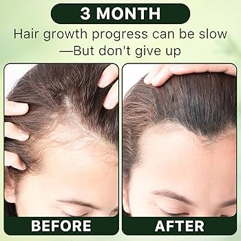 7 in 1 hair food oil