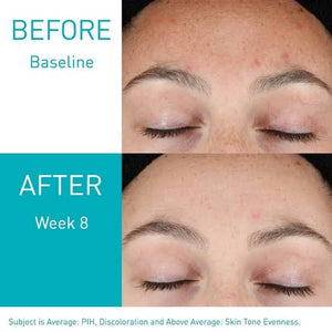 CeraVe skin renewing & resurfacing retinol serums