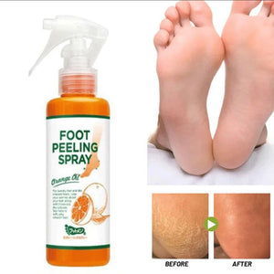 Foot peeling spray